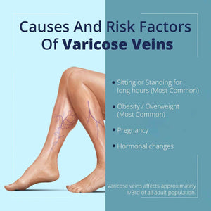 Cream Ayurvedic Solution for Management of Varicose Veins, Spider Veins, Varicocele Helps Reach The Root Cause of varicose Veins Reduces Cramps, Itching & Swelling. Single Tube (25 GMS).