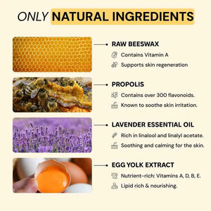 MyMagicHealer Universal Flare Care - Multi-Purpose Solution - Skin Flare-Ups - Hidradenitis Suppurativa, Folliculitis, Boils, Cysts - Anti-Chafing - Irritated Skin Relief w/Propolis & Egg Yolk 1 oz