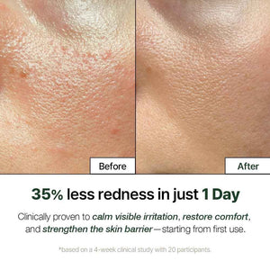 NATURAL DERMA PROJECT NDP Cica Cream - Gel Face Moisturizer for Sunburn Relief, lightweight Korean Moisturizer for Sensitive Skin, Centella Asiatica