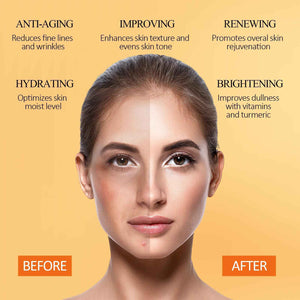 SHVYOG Turmeric Vitamin C Clay Mask with Kaolin Clay for Dull & Blemish-Prone Skin, Deep Cleansing Facial Mask, Face Masks Skincare for Controlling Oil