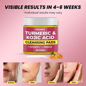 Turmeric Kojic Acid Cleansing Pads for Face Dark Spots - Hydrates & Plumps - With Vitamin C & E, Sensitive Skin Friendly (50 Pads)