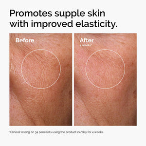 The Ordinary Serum Favorites Set – Hyaluronic Acid 2% + B5, Niacinamide 10% + Zinc 1%, Caffeine Solution 5% + EGCG Eye Serum, Serums for Hydrating,
