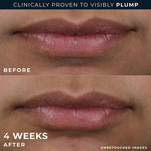 RoC Derm Correxion Lip Volumizer - Lip Plumper Peptide Treatment with Hyaluronic Acid & Vitamin E + Line Smoothing Eye Cream Packette