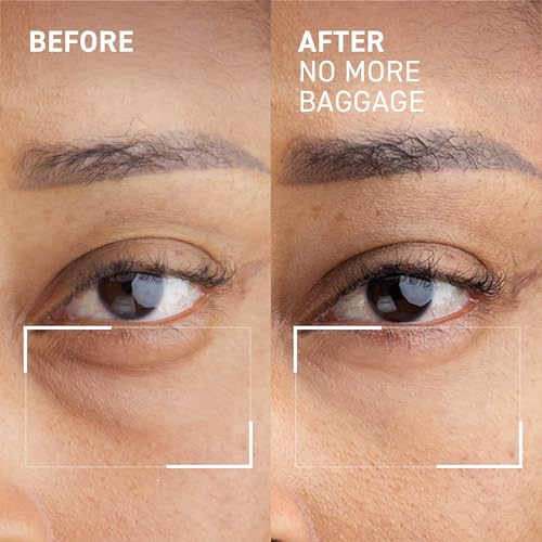 Dr. Brandt Needles No More, No More Baggage (Pack of 2, 0.23 oz Each) – Travel-Ready Instant Eye De-Puffer & Dark Circle Eraser Duo