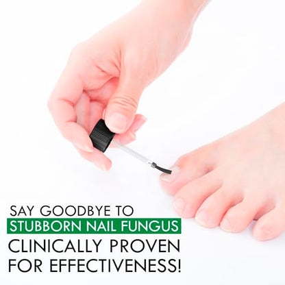 Viking Revolution Toenail Fungus Treatment Extra Strength with 1% Tolnaftate OTC