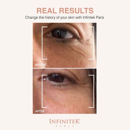 Infinitek Paris Multi-Active Collagen Eye Cream - Anti-Aging & Dark Circles (15ml)