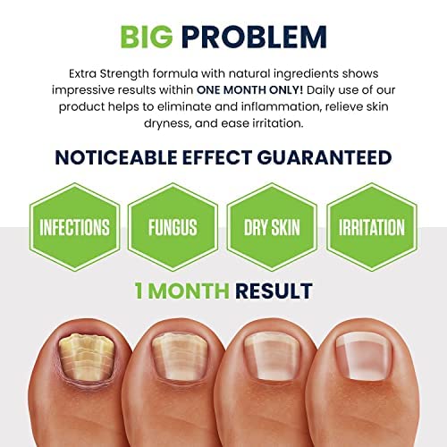 Toenail Fungus Treatment Extra Strength - Advance nail fungus treatment for fingernails