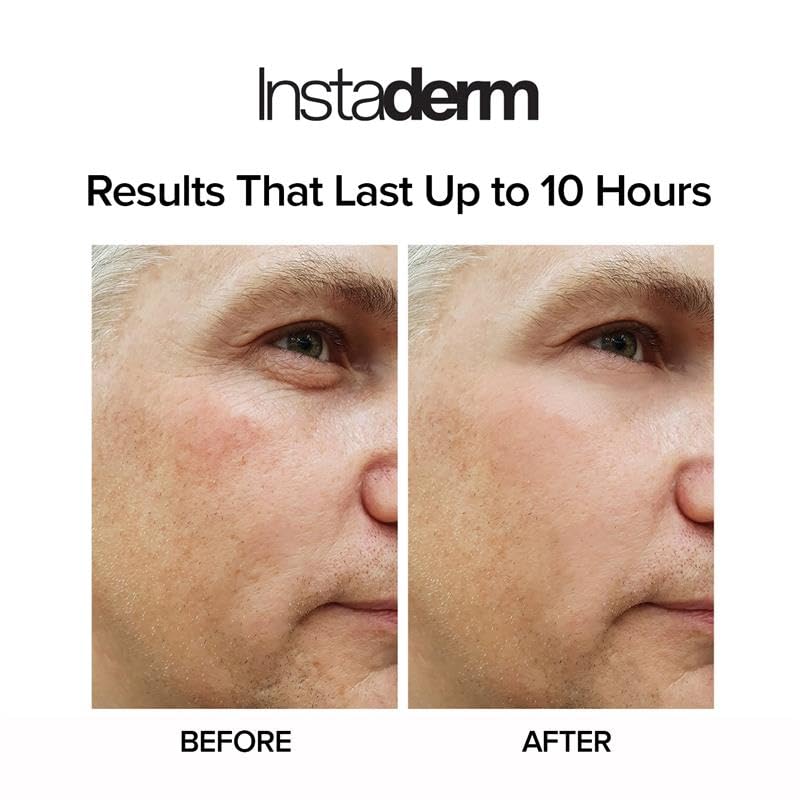 Instant Eye Tightener - Fast-Acting Under Eye Bag & Dark Circle Remover (15ml)