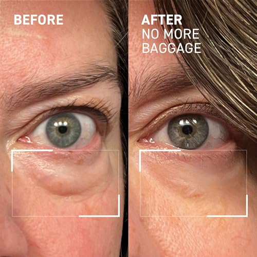 Dr. Brandt Needles No More, No More Baggage (0.23 oz) – Instant Under-Eye De-Puffer & Dark Circle Eraser | Travel Size