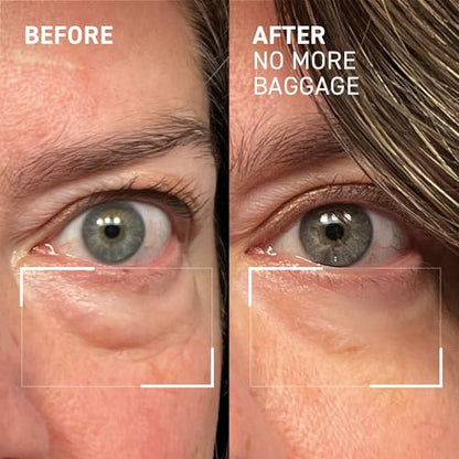Dr. Brandt Needles No More, No More Baggage (0.5 oz) – Instant Under-Eye De-Puffer & Dark Circle Eraser Gel