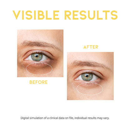 Dark Circle Remover Eye Serum with Vitamin C, Niacinamide & Ceramide (30g)