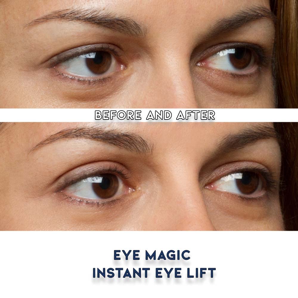 Premium Original Instant Eye Lift Kit – Eyelid Lift Strips with Wax/Gel for Droopy Upper Eyelids (64 Strips, Small/Medium)