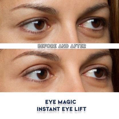 Premium Original Instant Eye Lift Kit – Eyelid Lift Strips with Wax/Gel for Droopy Upper Eyelids (64 Strips, Small/Medium)