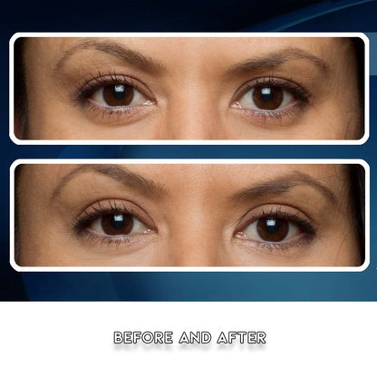 Premium Eye Lift Strips – Instant Eyelid Lift Tape for Droopy, Sagging & Hooded Eyelids, Transparent Hypoallergenic (80 Count, S/M)