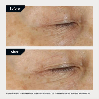 Revision Skincare D·E·J Eye Cream® (0.5 fl oz) - Advanced Anti-Aging Treatment with Cooling Metal Applicator