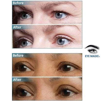 Premium Original Instant Eye Lift Kit – Eyelid Lift Strips with Wax/Gel for Droopy Upper Eyelids (64 Strips, Small/Medium)