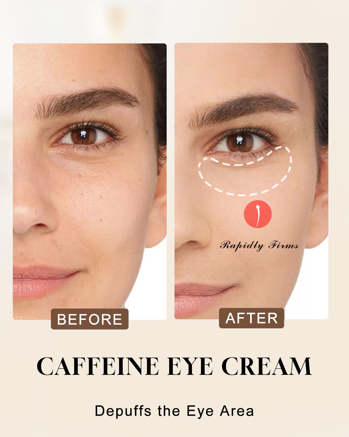 TJE Caffeine Eye Cream for Dark Circles & Puffiness - Hydrating Under Eye Treatment with Hyaluronic Acid & Vitamin E (15g)