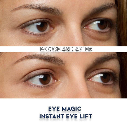 Eye Magic Premium Instant Eyelid Lift Refill (L/XL) – Invisible Eyelid Lift Strips for Droopy, Hooded Eyelids