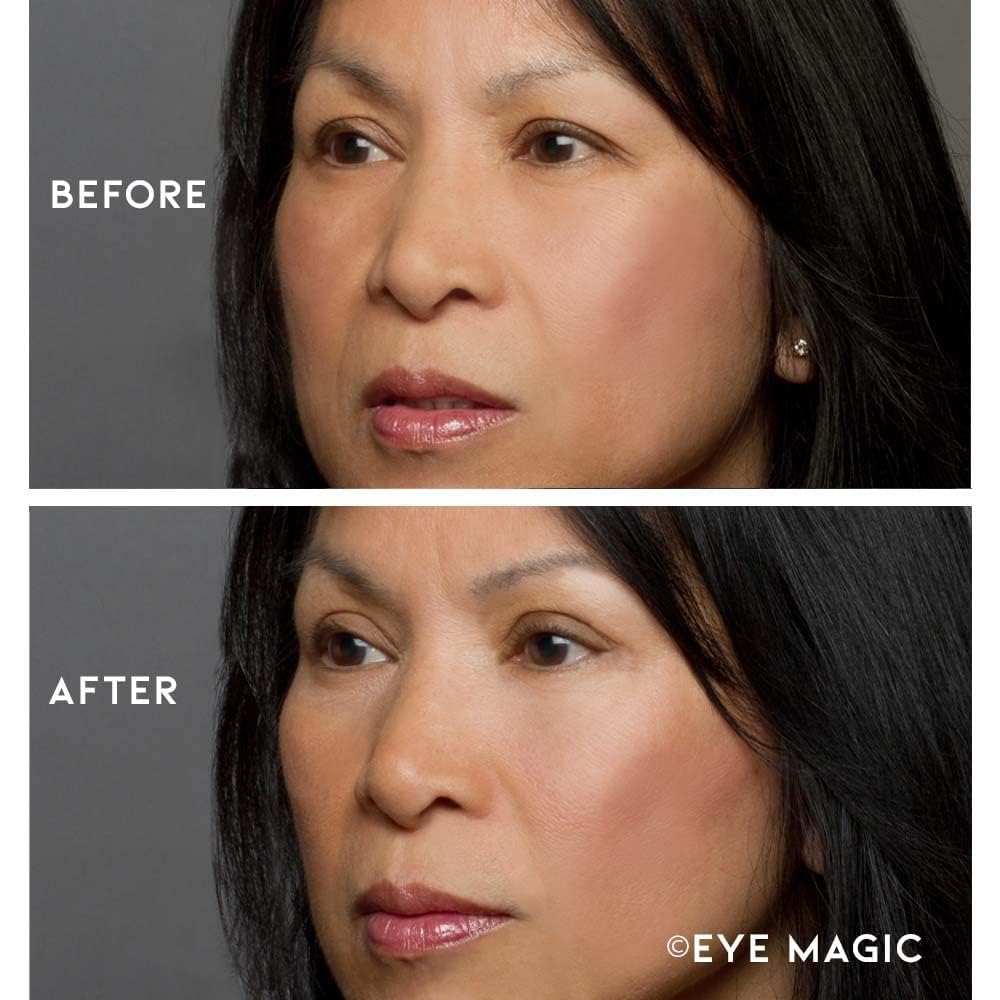 Eye Magic Premium Instant Eyelid Lift Refill (L/XL) – Invisible Eyelid Lift Strips for Droopy, Hooded Eyelids