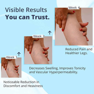 Cream Ayurvedic Solution for Management of Varicose Veins, Spider Veins, Varicocele Helps Reach The Root Cause of varicose Veins Reduces Cramps, Itching & Swelling. Single Tube (25 GMS).