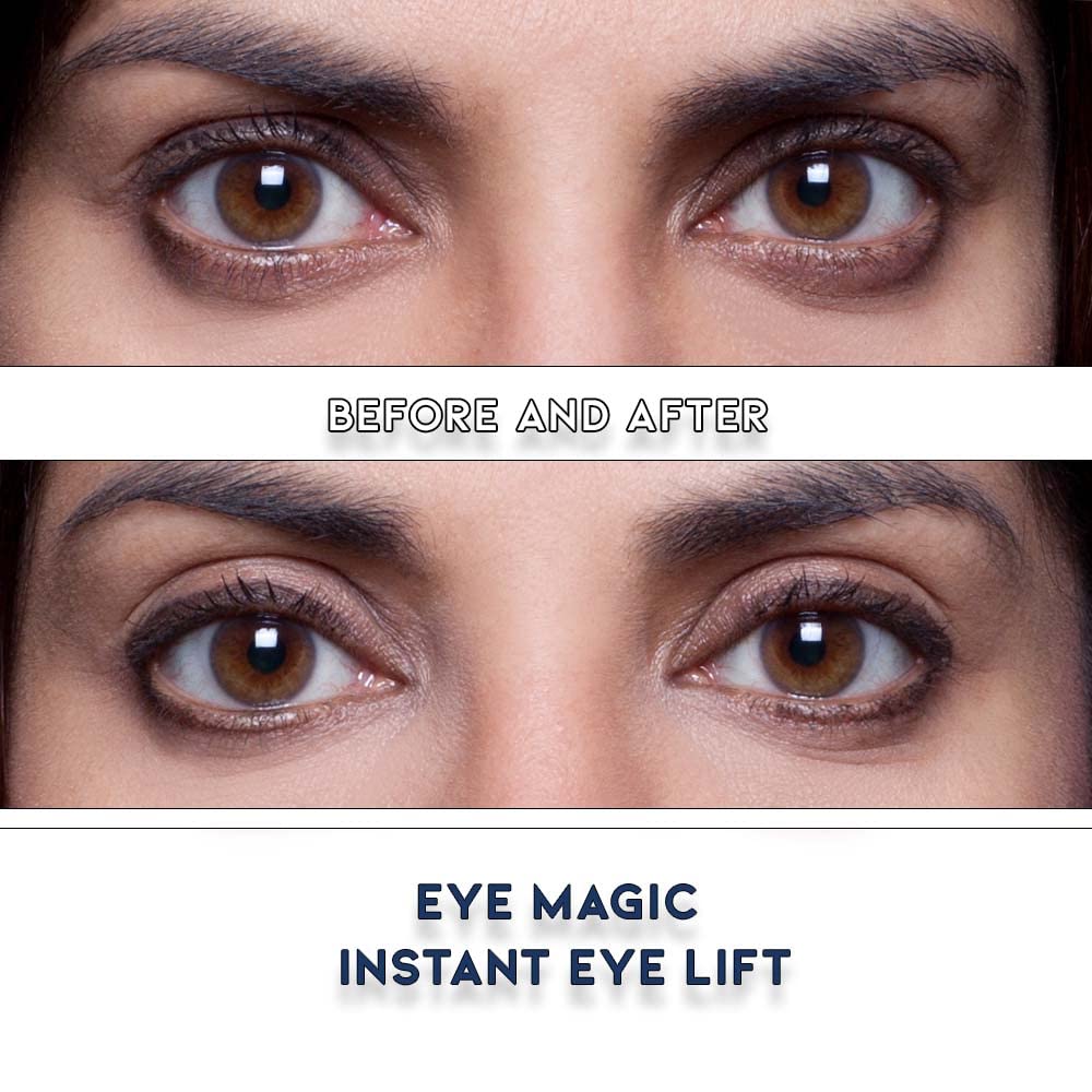 Eye Magic Premium Instant Eyelid Lift Refill (L/XL) – Invisible Eyelid Lift Strips for Droopy, Hooded Eyelids