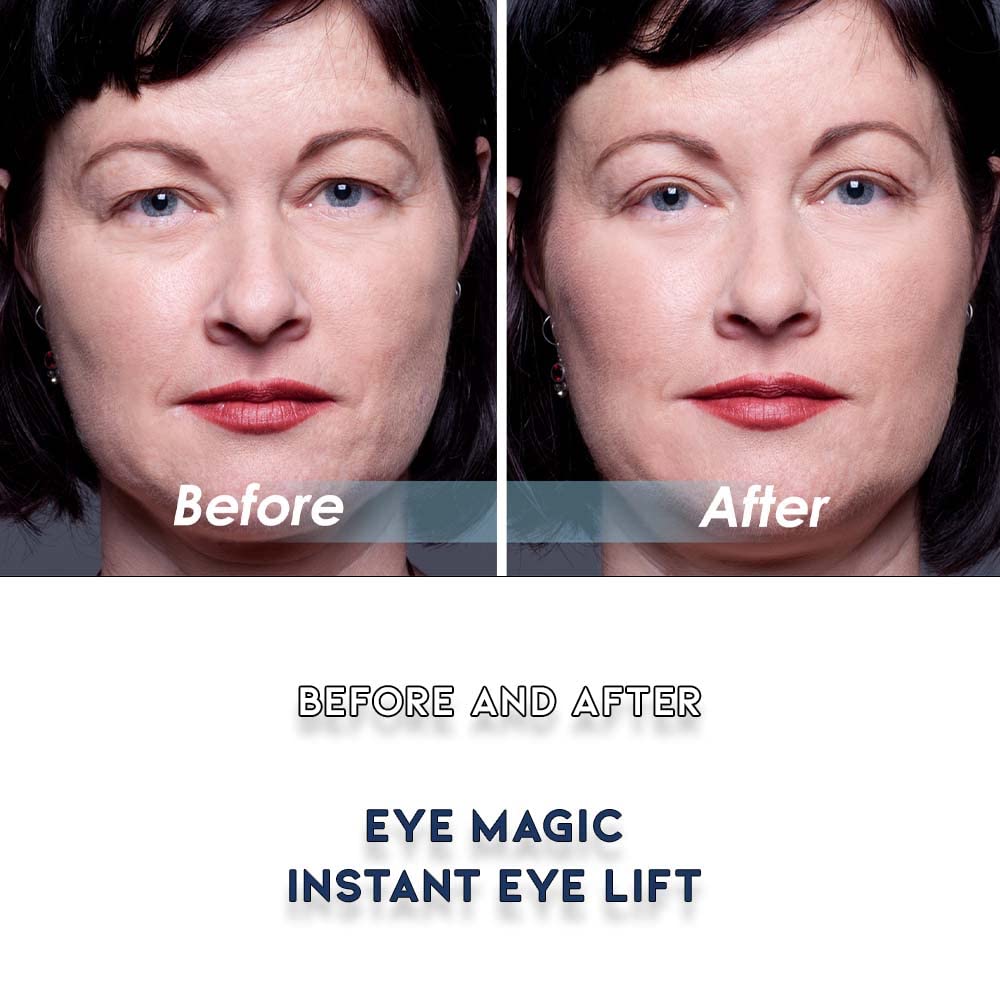 Premium Eye Lift Strips – Instant Eyelid Lift Tape for Droopy, Sagging & Hooded Eyelids, Transparent Hypoallergenic (80 Count, S/M)