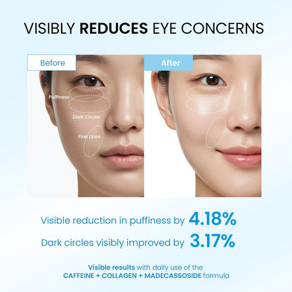 Dongyu Caffeine Under Eye Cream - Anti-Aging & Firming Collagen Eye Care for Puffy Eyes (Light Blue) - Daily Use Morning & Night