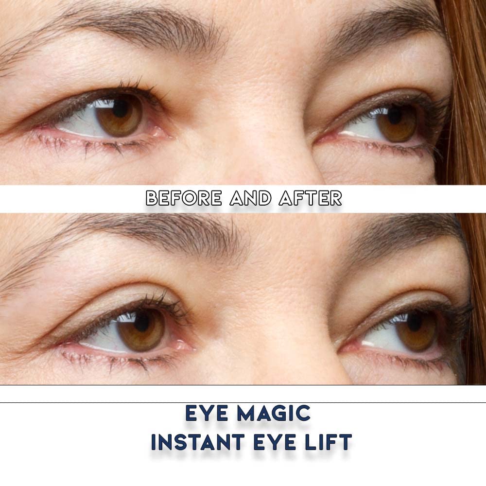 Premium Original Instant Eye Lift Kit – Eyelid Lift Strips with Wax/Gel for Droopy Upper Eyelids (64 Strips, Small/Medium)