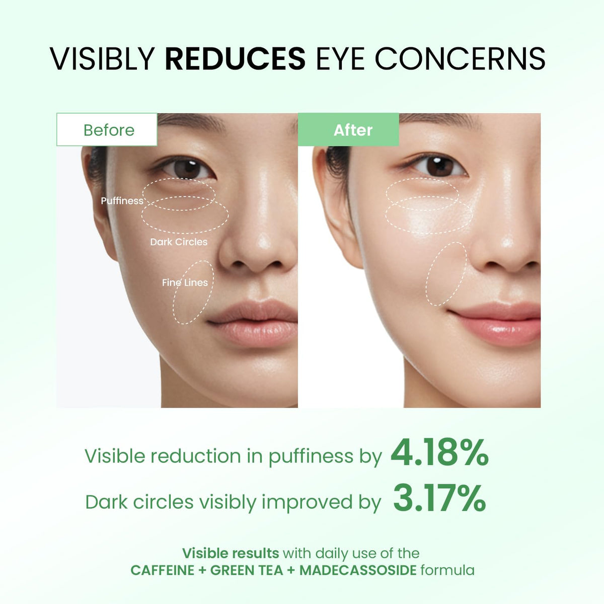 Dongyu Caffeine & Green Tea Eye Cream (Green) – Anti-Aging & Depuffing Treatment for Beauty Enthusiasts | Morning & Night Use