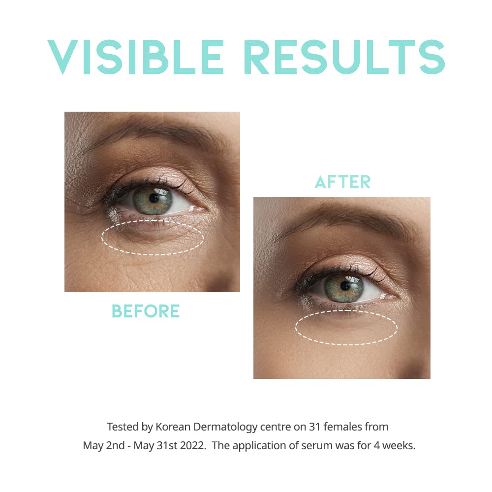 Korean Retinol Eye Cream Serum for Wrinkles, Dark Circles & Puffiness (30g)