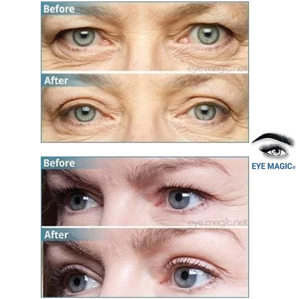 Premium Original Instant Eye Lift Kit – Eyelid Lift Strips with Wax/Gel for Droopy Upper Eyelids (64 Strips, Small/Medium)