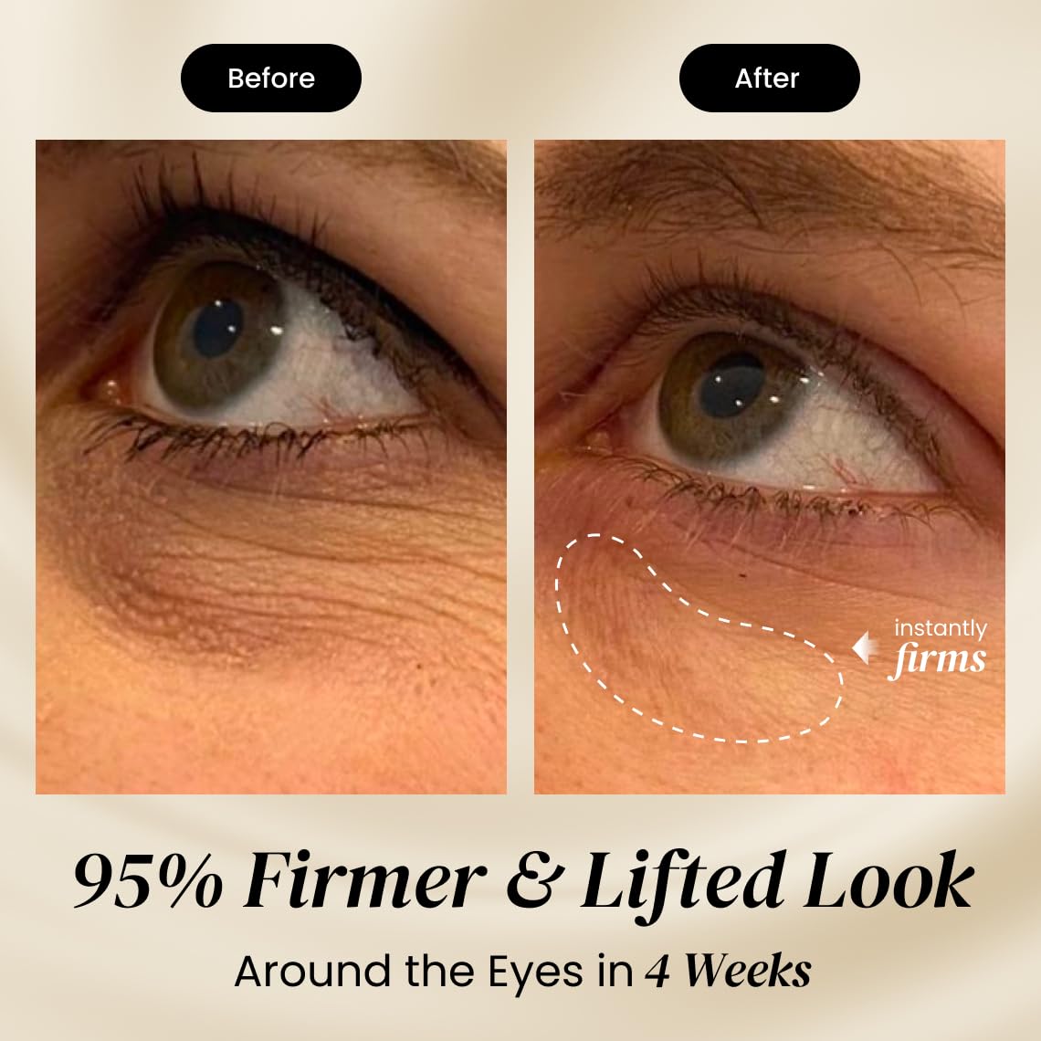 Eliré Firming Eye Cream - Instant Lift & Tightening (15ml)