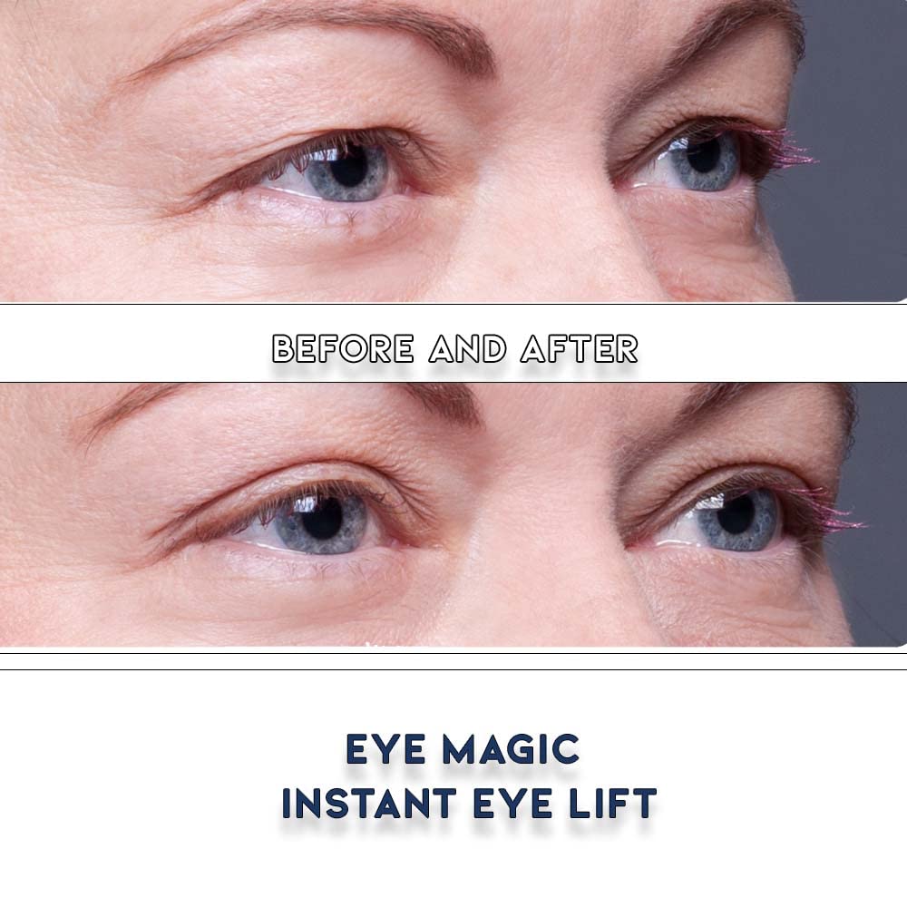 Premium Eye Lift Strips – Instant Eyelid Lift Tape for Droopy, Sagging & Hooded Eyelids, Transparent Hypoallergenic (80 Count, S/M)