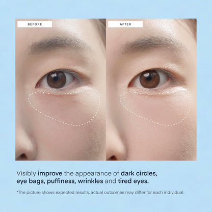 TEREZ & HONOR Caffeine Eye Patches (60 Pcs) - Korean Hydrogel Masks with Niacinamide & Hyaluronic Acid for Dark Circles & Puffiness