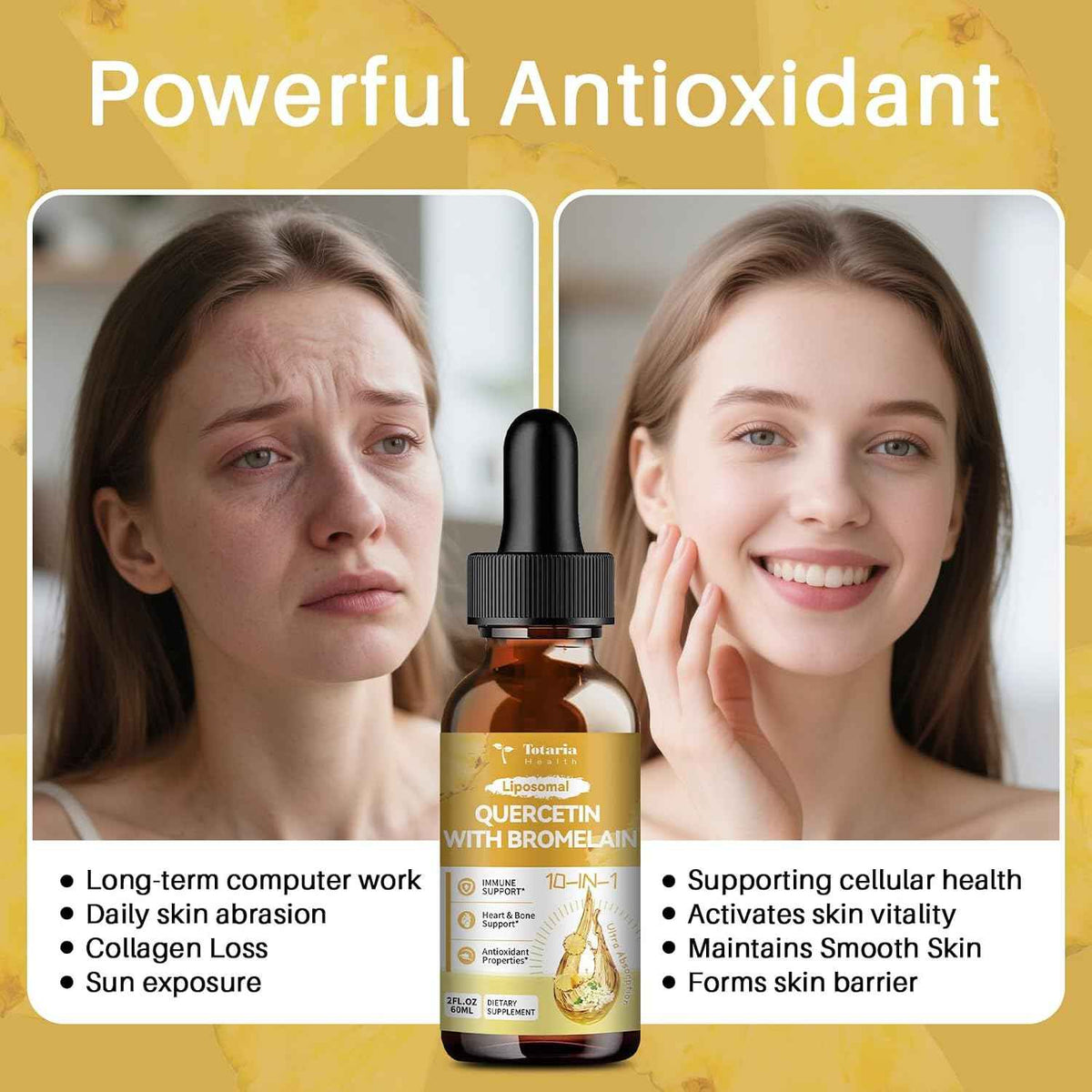 Totaria Liposomal Quercetin with Bromelain Liquid Drops - High Absorption Quercetin 1000mg & Bromelain 500mg Plus Elderberry,Vitamin C,Zinc for Immune & Antioxidant & Heart & Bone Support- 2 Fl Oz