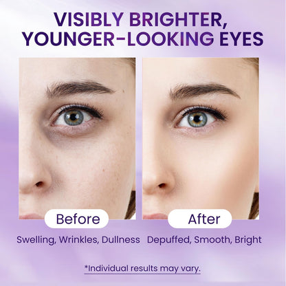 Doracome Caffeine & Retinol Under Eye Serum - Fast-Absorbing Correction for Puffy Bags, Dark Circles & Wrinkles
