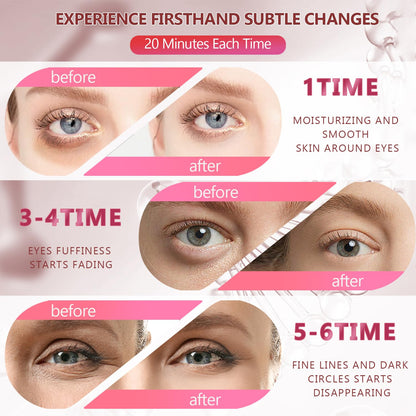 Yargkos Pink Collagen Under Eye Patches - 60 Pcs (30 Pairs)