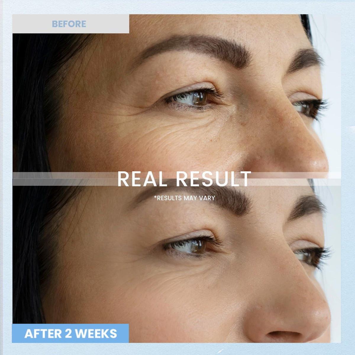 Retinol Night Care Eye Cream - Anti-Wrinkle & Dark Circles Treatment