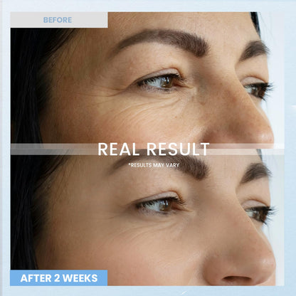 Retinol Night Care Eye Cream - Anti-Wrinkle & Dark Circles Treatment