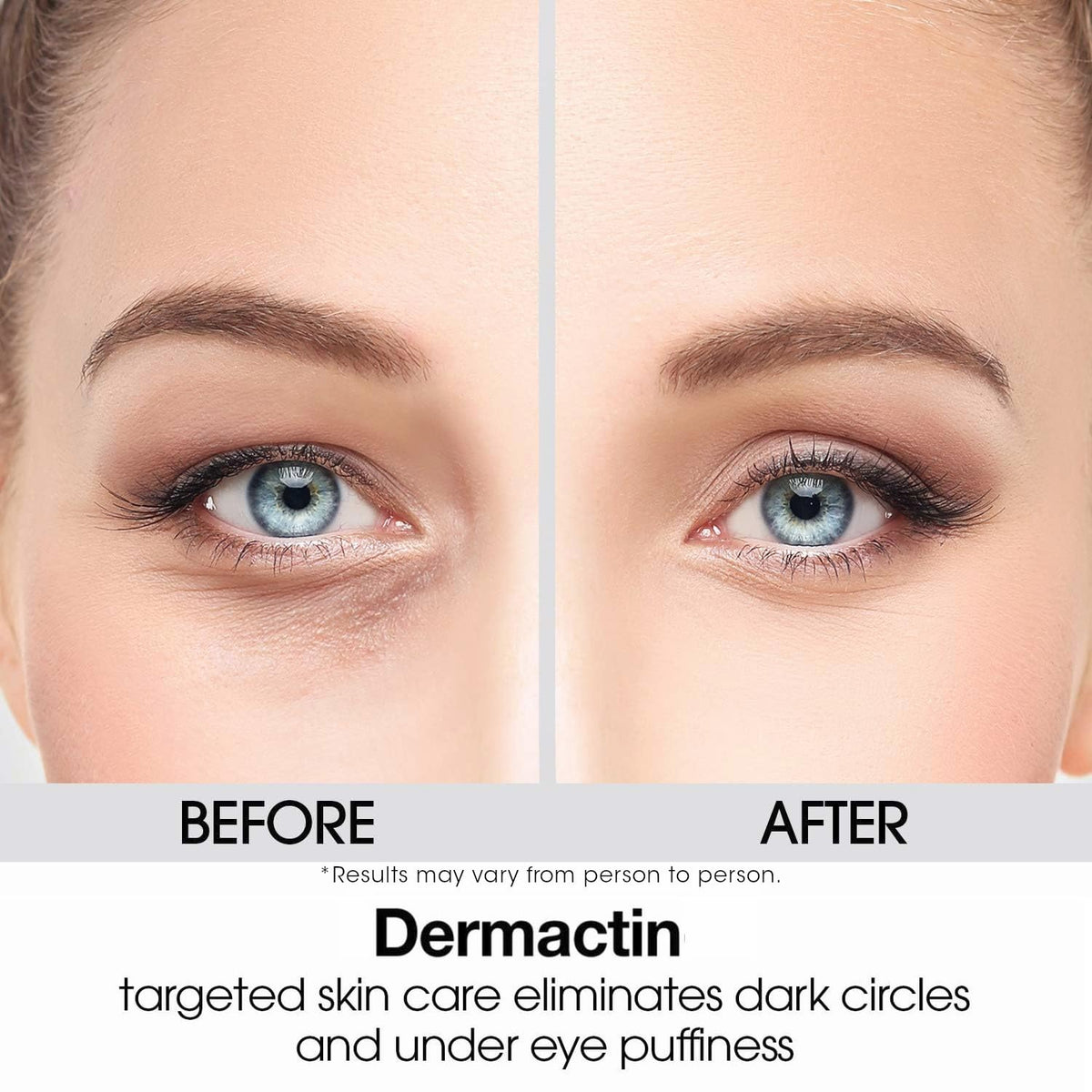 Dermactin Upper Eyelid Cream 1 oz – Firming & Toning Treatment for Sagging and Drooping Eyelids – Anti-Aging Eye Lift Cream for Sensitive Skin