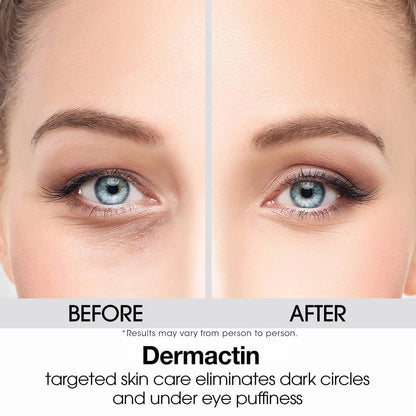 Dermactin Upper Eyelid Cream 1 oz – Firming & Toning Treatment for Sagging and Drooping Eyelids – Anti-Aging Eye Lift Cream for Sensitive Skin