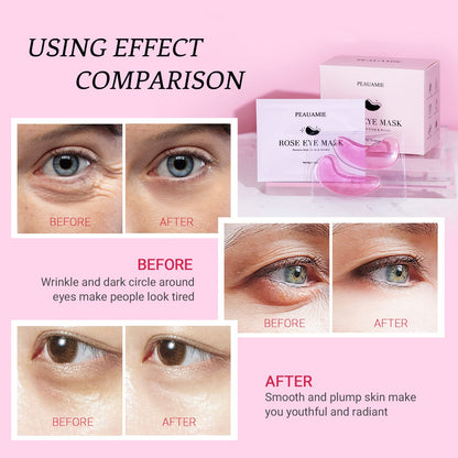 PEAUAMIE Rose Under Eye Patches (30 Pairs) – Soothing Rose Extract Eye Mask for Dark Circles, Puffiness & Fine Lines | Hydrating Skincare