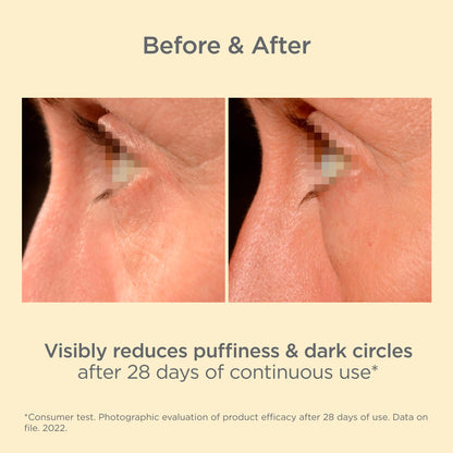 ISDIN Isdinceutics K-Ox Eyes - Vitamin K Oxide Eye Cream (0.5 oz)