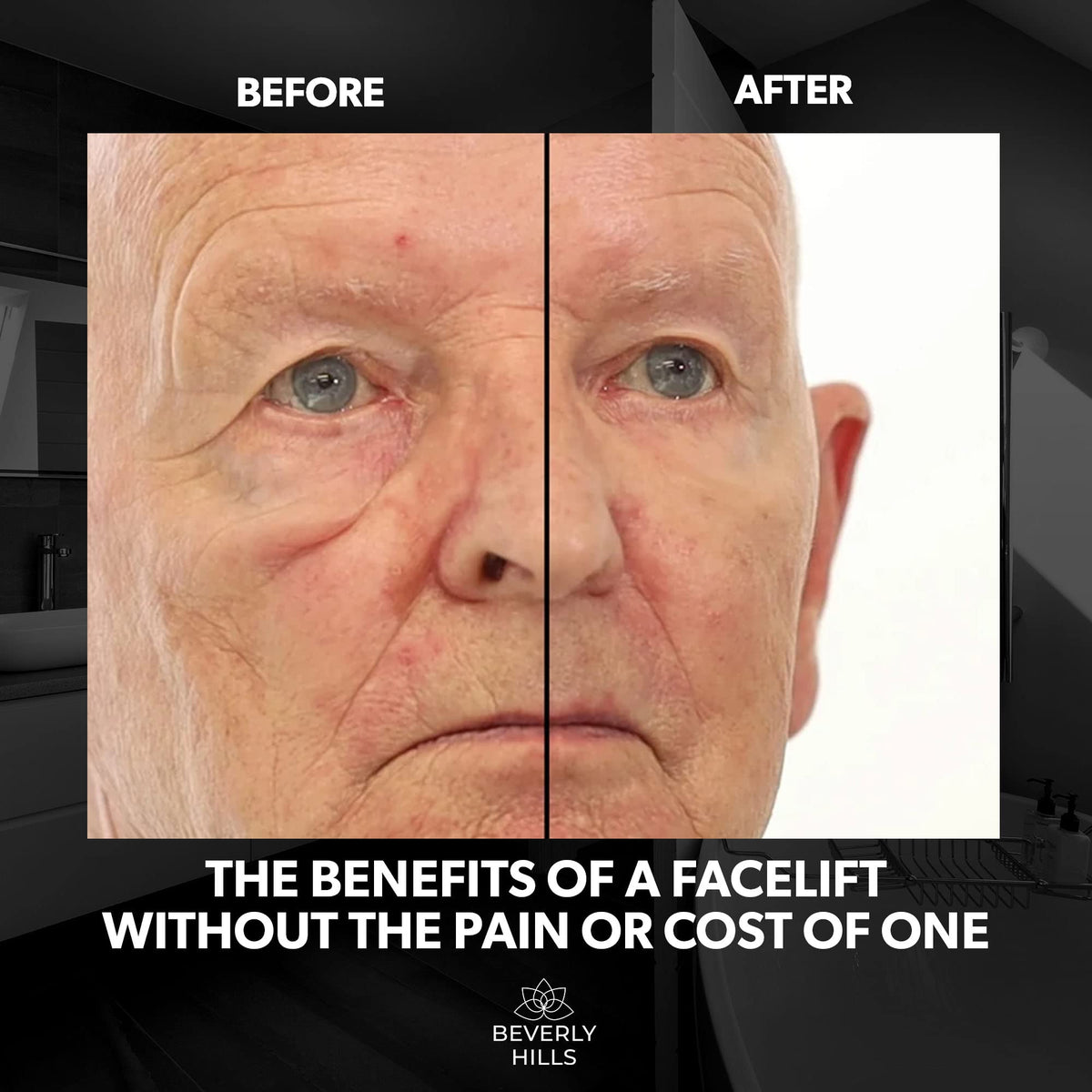 Beverly Hills Men's Instant Facelift & Eye Serum – Dark Circles, Puffy Eyes & Wrinkle Treatment