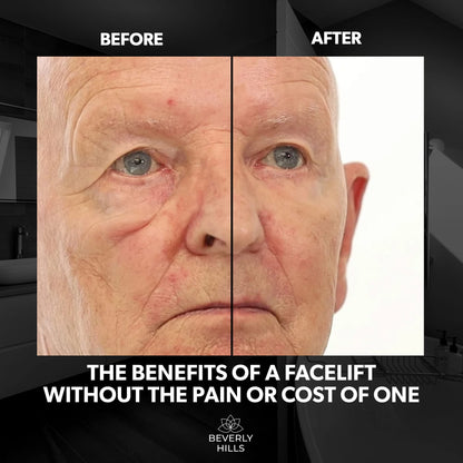 Beverly Hills Men's Instant Facelift & Eye Serum – Dark Circles, Puffy Eyes & Wrinkle Treatment
