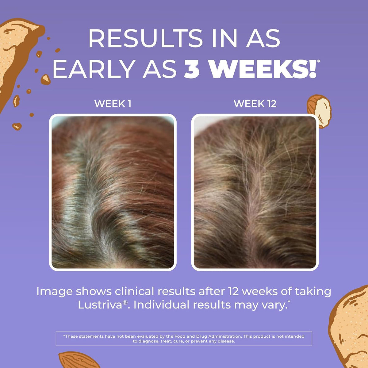 MaryRuth's Hair Growth Max Liposomal for Women - Lustriva + Biotin 10000mcg + Pumpkin Seed Oil - Thicker Hair - Hair Care - Wrinkles, Fine Lines, Skin Care - Ages 18+ - CLP Certified - 15.22 Fl Oz