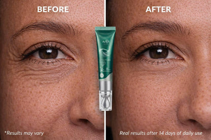 MyIDi Rejuvenating Anti-Aging Serum – 5 Peptide Lifting Fluid (15ml)