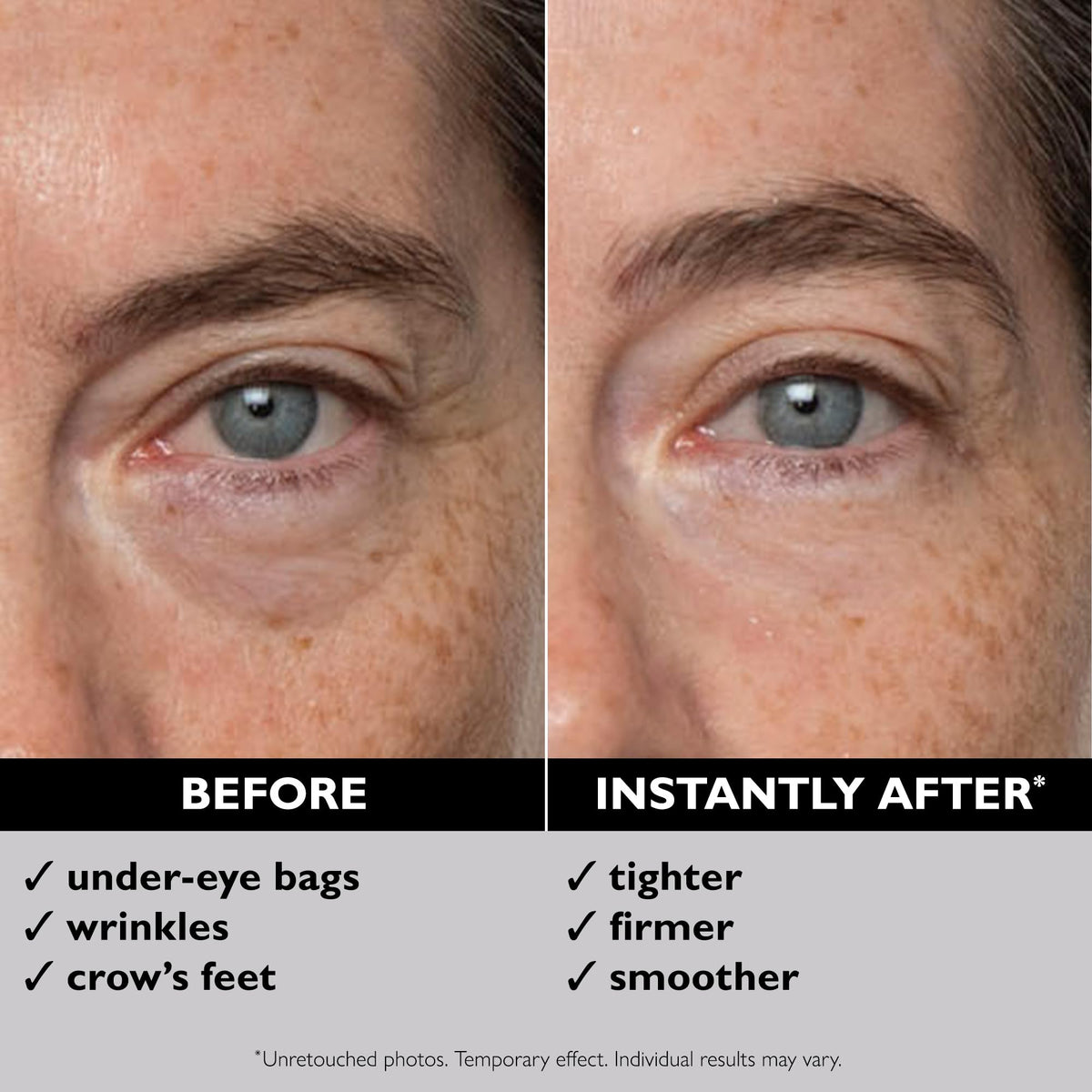 Peter Thomas Roth Instant FIRMx® Eye - Temporary Eye Tightener for Instant De-Puffing & Smoothing
