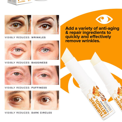 Turmeric Retinol Eye Stick - LumiBalm Under Eye Cream for Dark Circles & Puffiness - Anti-Aging Eye Balm for Wrinkles & Fine Lines (0.5oz)
