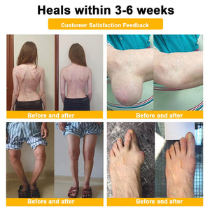Luhaka Botulinum Toxin & Bee Venom Pain-Relief Bone Healing Cream,Bee Venom Cream,Effectively improve joint mobility (1PC) LuhakaBuy Supplements Australia